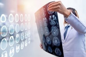 Advice From a Top Personal Injury Lawyer in Toronto