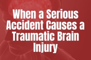 When a serious accident causes a traumatic brain injury call Cariati Law, Ontario's leading personal injury law firm.