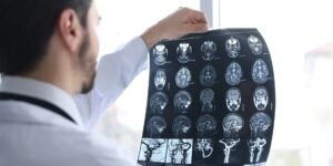 When suffering a traumatic brain injury in a car accident, hire Cariati Law to manage your serious car accident claim.